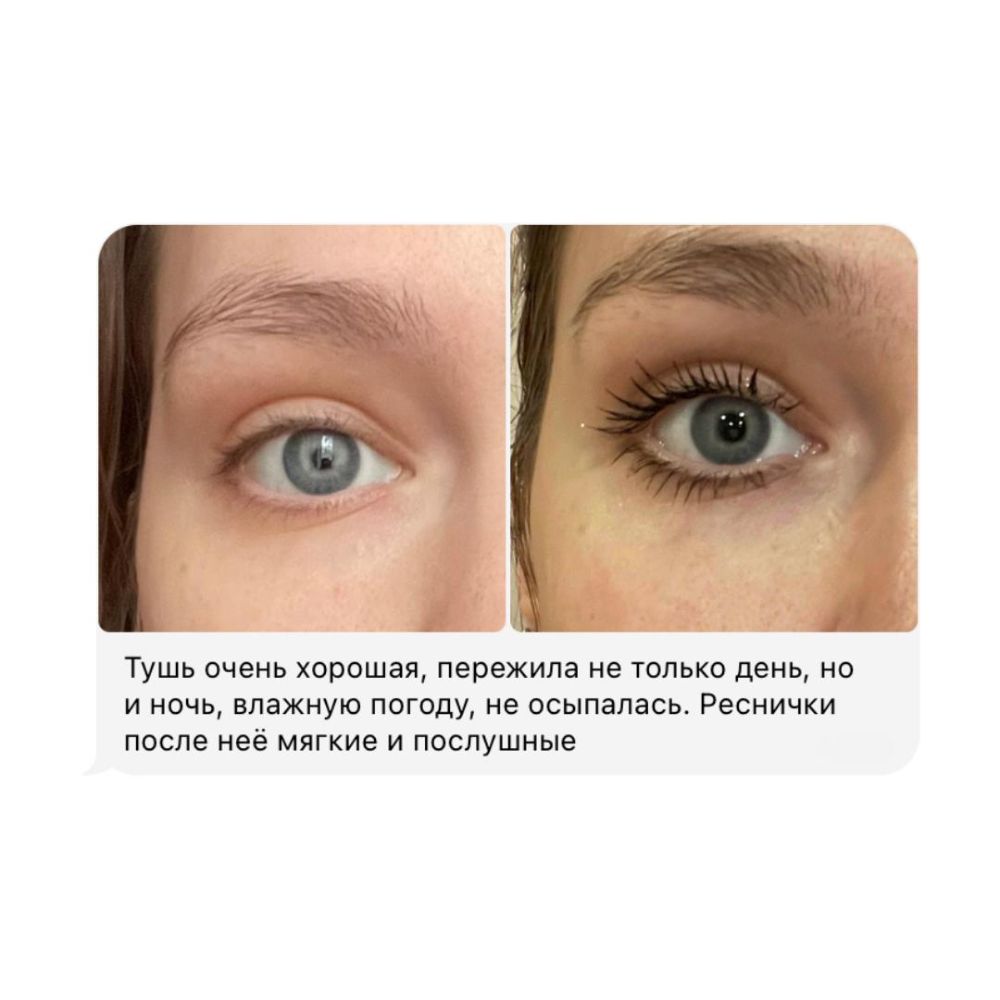 Careprost